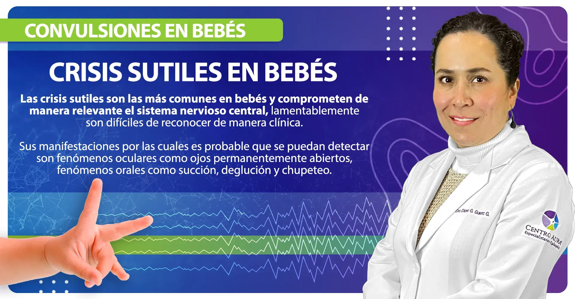 Las crisis sutiles en bebés son las más comunes
