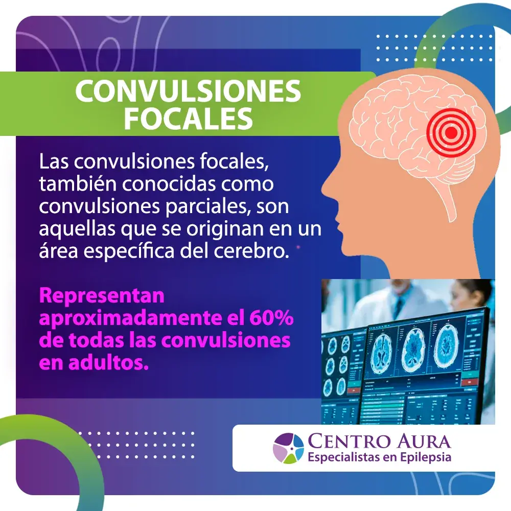 Convulsiones focales